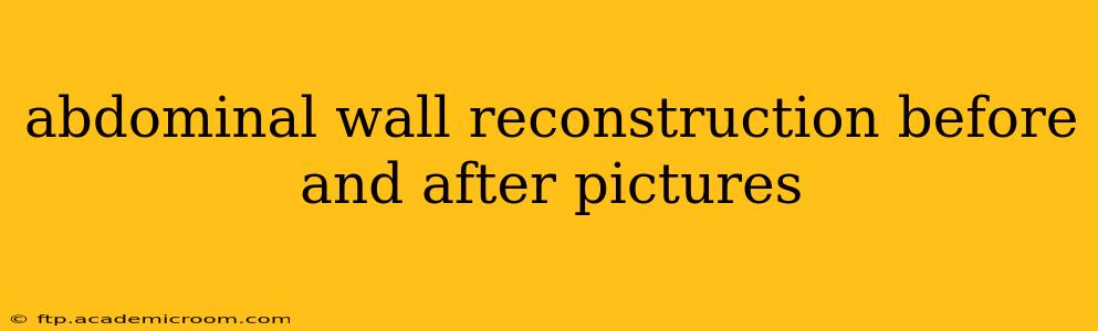 abdominal wall reconstruction before and after pictures