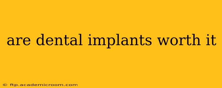 are dental implants worth it