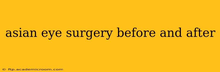 asian eye surgery before and after