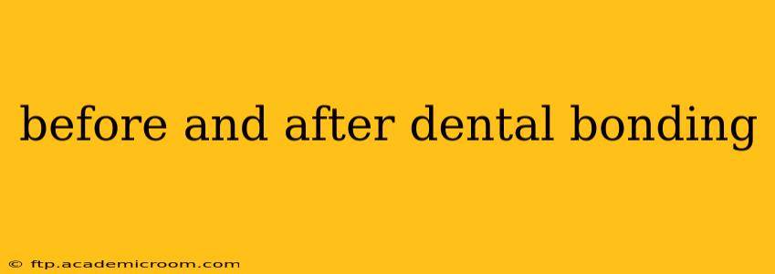before and after dental bonding