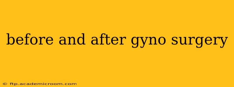 before and after gyno surgery