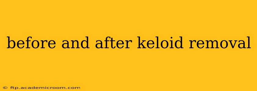 before and after keloid removal