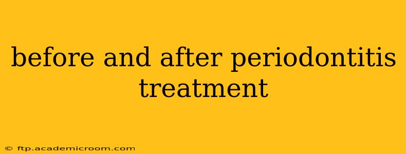 before and after periodontitis treatment