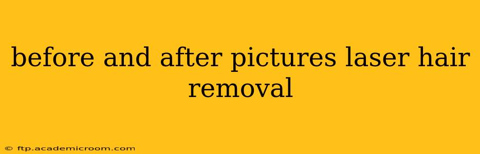 before and after pictures laser hair removal