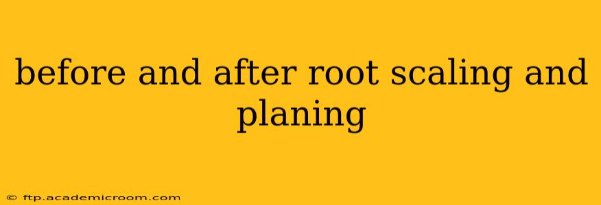 before and after root scaling and planing