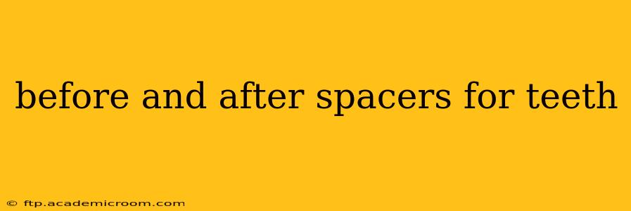 before and after spacers for teeth