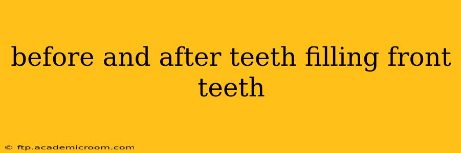 before and after teeth filling front teeth