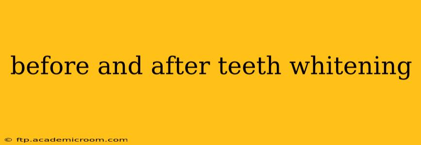 before and after teeth whitening