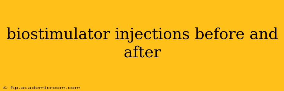 biostimulator injections before and after