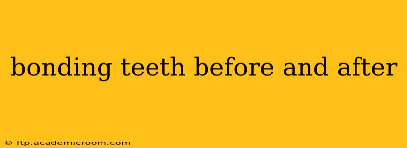 bonding teeth before and after