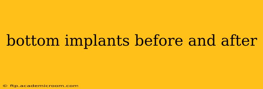 bottom implants before and after