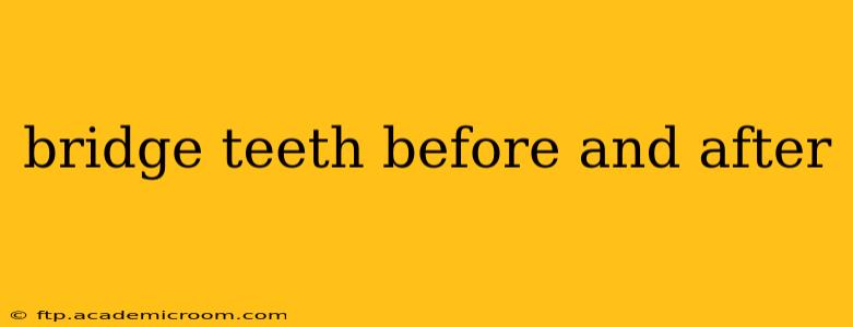 bridge teeth before and after