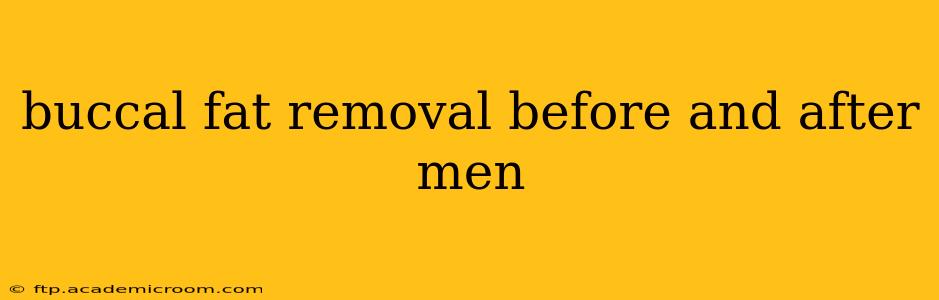 buccal fat removal before and after men