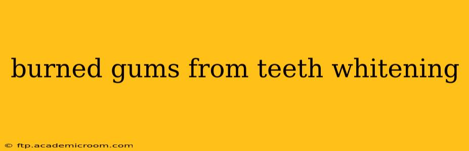 burned gums from teeth whitening