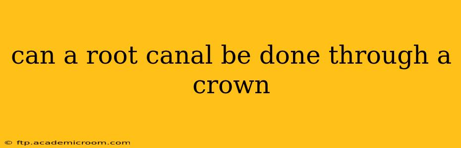 can a root canal be done through a crown