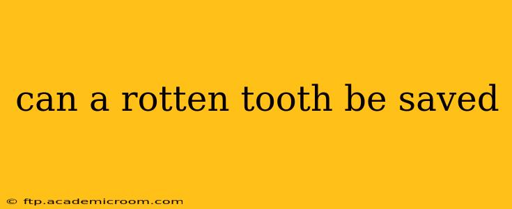 can a rotten tooth be saved