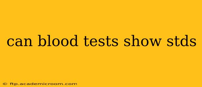 can blood tests show stds