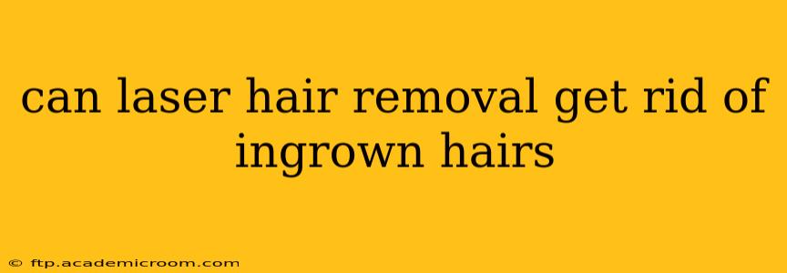 can laser hair removal get rid of ingrown hairs