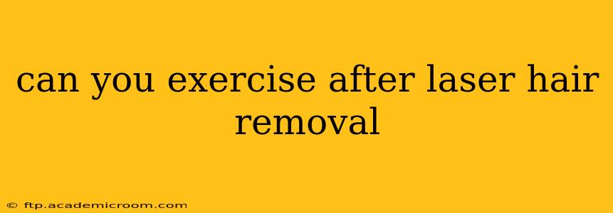 can you exercise after laser hair removal