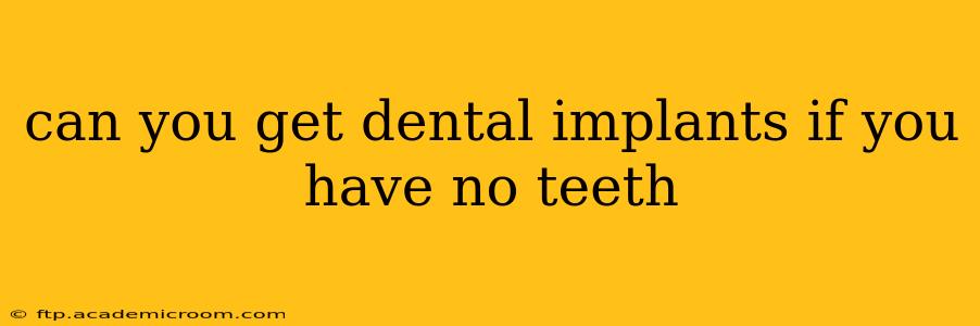 can you get dental implants if you have no teeth