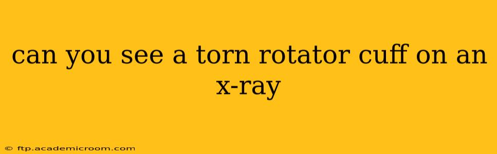 can you see a torn rotator cuff on an x-ray