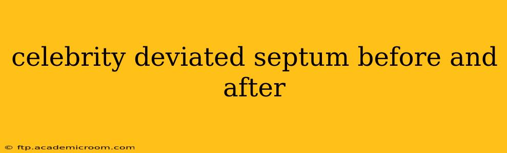 celebrity deviated septum before and after