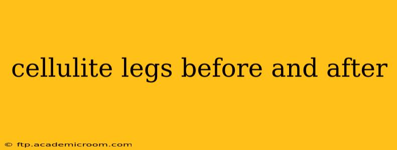 cellulite legs before and after