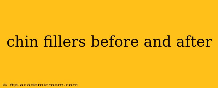 chin fillers before and after