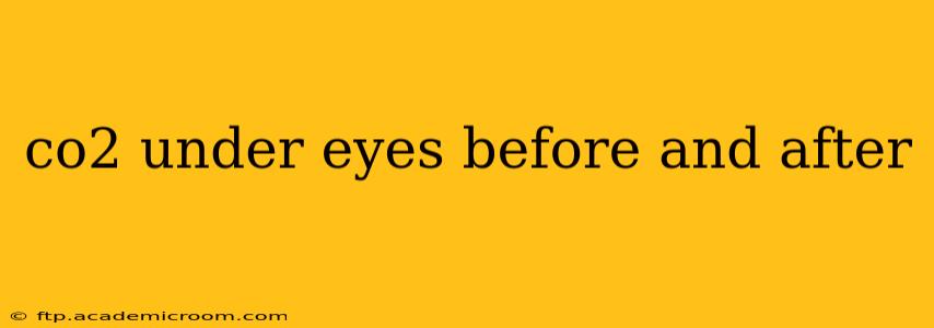 co2 under eyes before and after