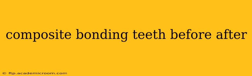 composite bonding teeth before after