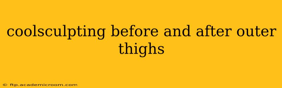 coolsculpting before and after outer thighs