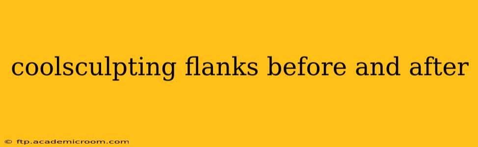 coolsculpting flanks before and after