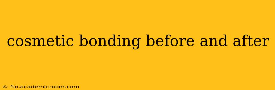 cosmetic bonding before and after