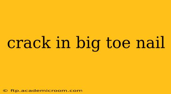 crack in big toe nail