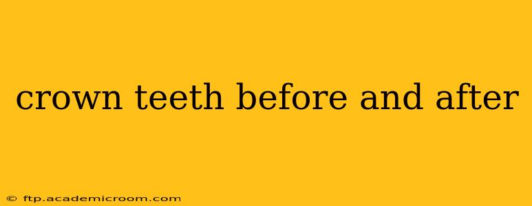 crown teeth before and after