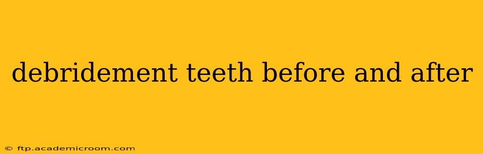 debridement teeth before and after