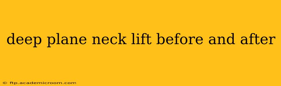 deep plane neck lift before and after