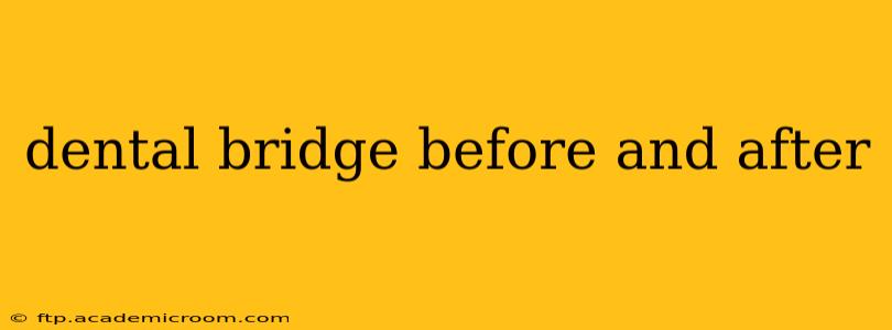 dental bridge before and after