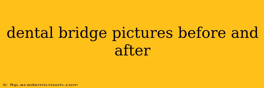dental bridge pictures before and after