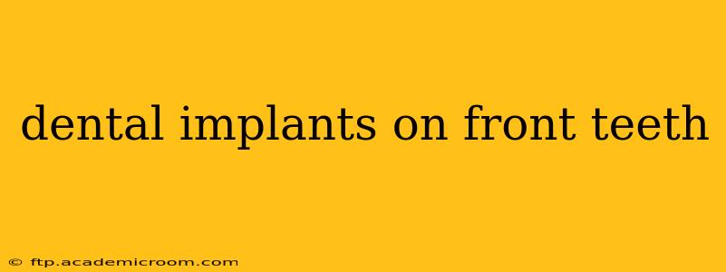 dental implants on front teeth