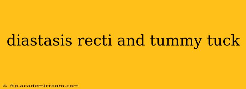 diastasis recti and tummy tuck