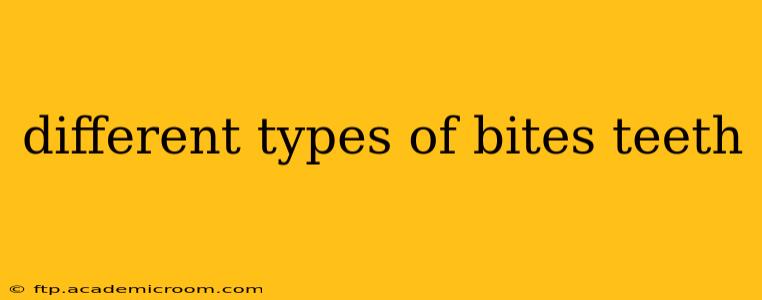 different types of bites teeth