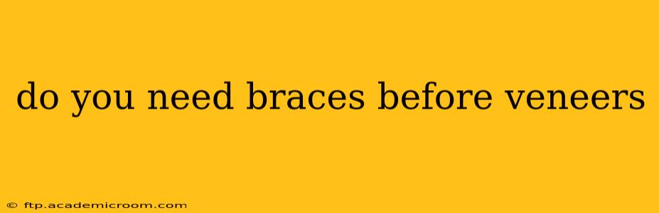 do you need braces before veneers