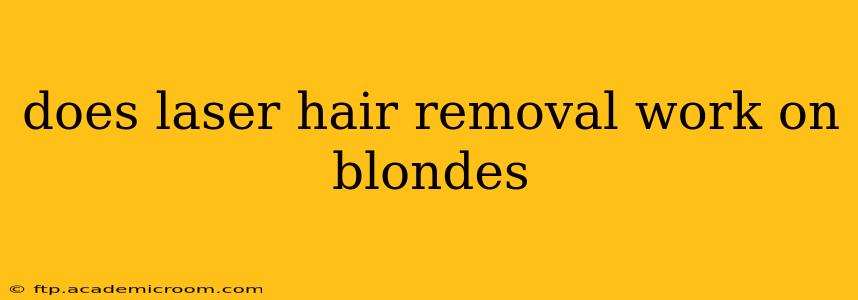 does laser hair removal work on blondes