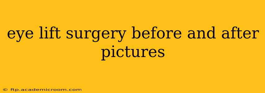 eye lift surgery before and after pictures