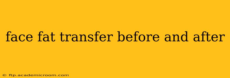 face fat transfer before and after