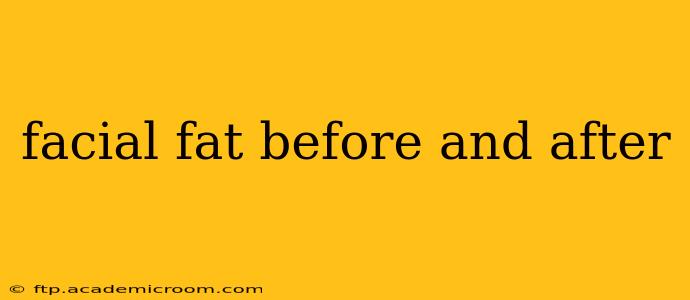 facial fat before and after