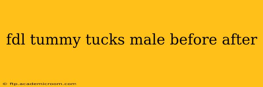 fdl tummy tucks male before after