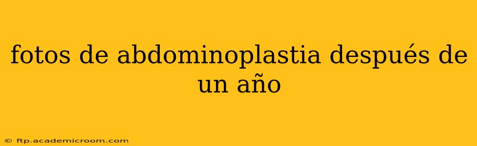 fotos de abdominoplastia después de un año