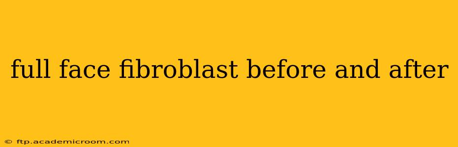full face fibroblast before and after